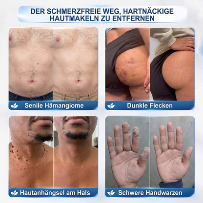 🎁𝐇𝐈𝐒𝐊𝐈𝐍® – Nur noch 5 Boxen verfügbar!Wir gewähren Ihnen 30% Extra-Rabatt.  Wenn Sie jetzt zögern, gibt es erst im nächsten Jahr wieder eine Chance.