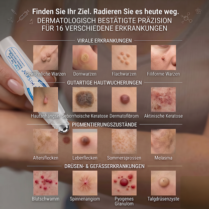 🎁𝐇𝐈𝐒𝐊𝐈𝐍® – Nur noch 5 Boxen verfügbar!Wir gewähren Ihnen 30% Extra-Rabatt.  Wenn Sie jetzt zögern, gibt es erst im nächsten Jahr wieder eine Chance.